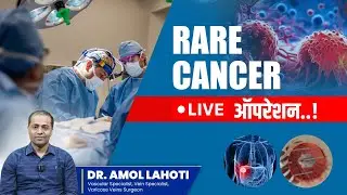 LIVE Rare Cancer Surgery &ndash; A Life-Saving Operation You Must See!