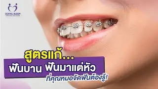 สูตรแก้ ฟันบาน จัดฟัน แล้ว ฟันมาแต่หัว ที่คุณหมอจัดฟันต้องรู้!