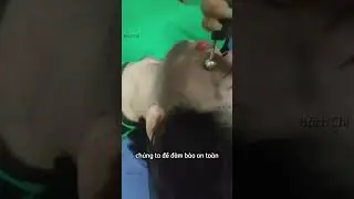 Ai cũng phải biết c&aacute;ch cạo gi&oacute; đ&uacute;ng c&aacute;ch