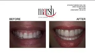 Dr. Marsh Live on Lakeside | Cleveland | Dr. Steve Marsh