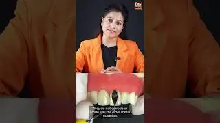 What are Dental Composite? | When to Get the Composite Done? | FMS Dental