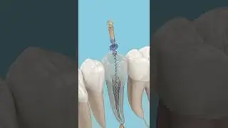 #dentalclinic #dentaltreatments #dentalproblems #3danimation
