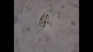 Stylonychia species, a freshwater ciliate