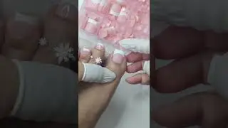 French toenails are so beautiful #nails #naildesigns #nailinspo #toenails #french #frenchnails