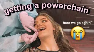 BRACES UPDATE: GETTING A POWERCHAIN !! | Lauren Hennessy