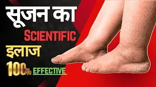 सूजन कारण,इलाज एवं सावधानियां!