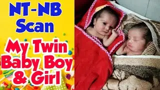 My Twin Baby Boy And Girl NT-NB Scan !! My First Ultrasound