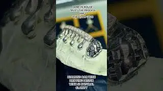 DIAMOND GRILLZ DIAMOND BARS DRIPPING DESIGN CONTACT US TODAY YO BOOK UR APPOINTMENT OR SHIPMENT