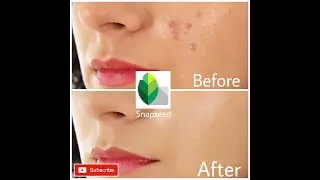 How to remove pimples using snapseed