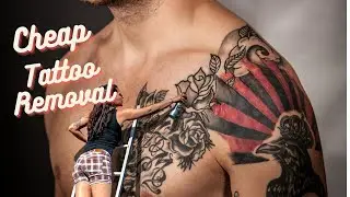 Cheap Tattoo Removal - Natural Tattoo Removal