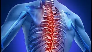 ★What Are Osteochondroses? Osteochondroses may cause pain and disability.