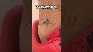 POV: Когда тебя КУСАЕТ КОМАР...🦟😡 #юмор #комедия #шорты