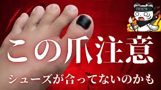 ランニングシューズから爪を守ろう！