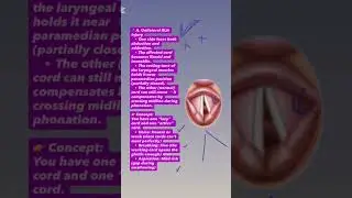 Заметки/раздаточные материалы по гортани | ВЫСОКАЯ ДОХОДНОСТЬ | Для MBBS FCPS USMLE PLAB MDMS JCAT