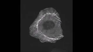 Calponin-3 is critical for coordinated contractility of actin stress fibers