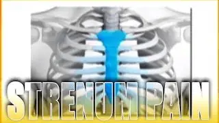 What causes pain in the sternum? | Usapang Pangkalusugan