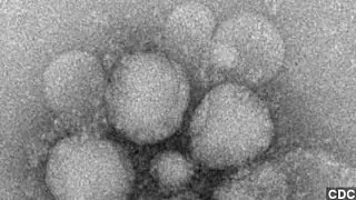 First Case Of Dangerous MERS Virus Reported In U.S.