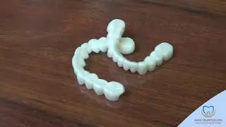 Mock-up Of Your Dream Smile