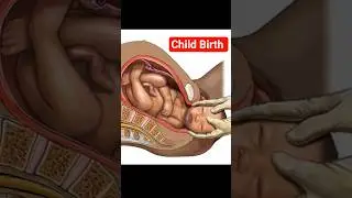 What Child Birth Is Actually Like