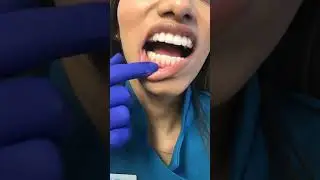 At home / How to stop Invisalign Irritation