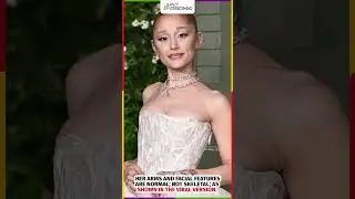Ariana Grande&rsquo;s Viral Photo: Real Health Crisis or Digital Manipulation?