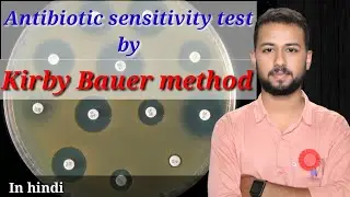 Antibiotic sensitivity test by disc diffusion method | kirby bauer disk diffusion method in hindi