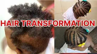 BABY WITH BALD SPOT? MAKE THIS SIMPLE AND CUTE HAIRSTYLE FOR YOUR BABY #naturalhair #kidshairstyles