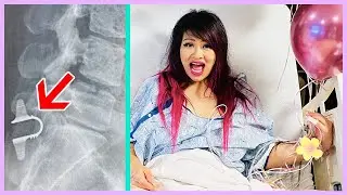 I BROKE MY BACK! SURGERY VLOG