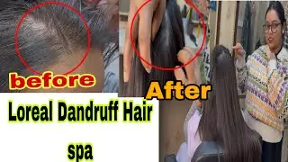 ❌Hair Spa / How To Remove Dandruff permanently in hindi /L&rsquo;Or&eacute;al Dandruff Hair spa/ step-by-step ✅😱
