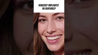 Veneers Vs Implants Vs Dentures: Which is Right for You?