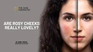 Are Rosy Cheeks really Lovely??