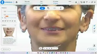 Metismile alignment