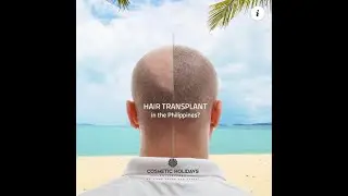 Hair transplant in the Philippines