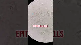 Urine sediments under the microscope #laboratory #microscope #underthemicroscope