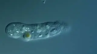 Saccamoeba, আণুবীক্ষণিক / microscopic creatures created by ALLAH, THE ONLY CREATOR