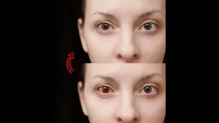 How to Make Eyes Look Clean & Clear in photoshop (Red Eye Removal)