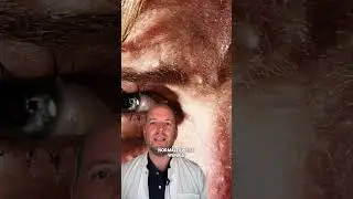 &Uuml;berm&auml;&szlig;iges Schwitzen im Gesicht