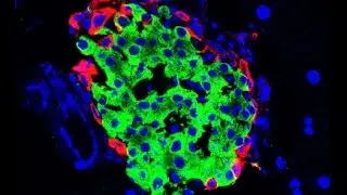 Beta Cells and Diabetes at UC Davis