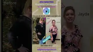 #weightlosstransformation #bariatricsurgery #gastricsleeve #weightlossjourney #wlscommunity#vsg#wls