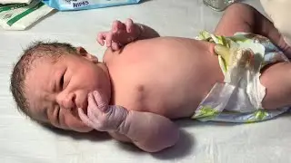 NICU Topping & Tilling Care,Feeding Trial in Newborn Baby | Step-by-Step Neonatal Feeding Care 