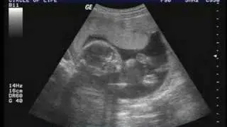 Baby kicking 18 weeks