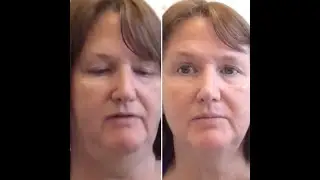 Clareblend MINI Tips