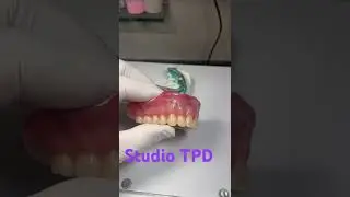 Pr&oacute;tese total (PT)