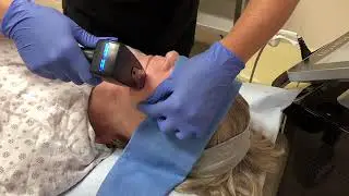 Morpheus8 Demonstration On Neck and Lower Face | San Diego | Aesthetic Arts Institute