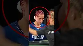 She Got Her Tattoo Slapped Off Her Face 💀 (@skrr_da)