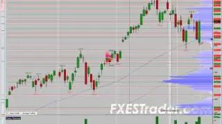 Why Auction Market Theory is the most powerful tool in trading!