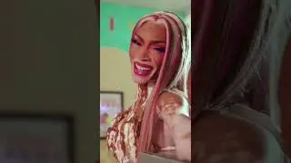 Winnie Harlow: Redefining Beauty With Vitiligo #winnieharlow #vitiligoawareness  #redefiningbeauty 