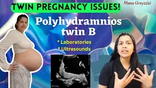 Dami ng AMNIOTIC FLUID ni TWIN B | (OGTT, TAXOPLASMA, CMV) | twin pregnancy update