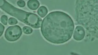 Gynaecology. Candidiasis. Candida albicans.