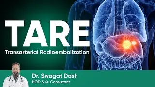 Терапия рака печени I Трансартериальная радиоэмболизация | Лечение TARE